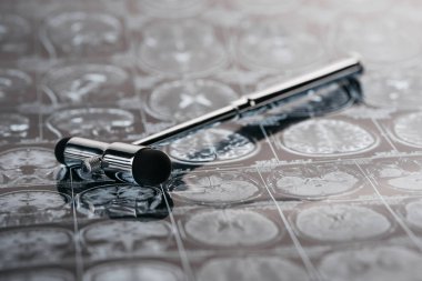 x-ışını resim üzerinde refleks çekici