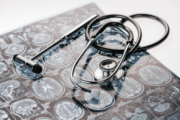 reflex hammer and stethoscope