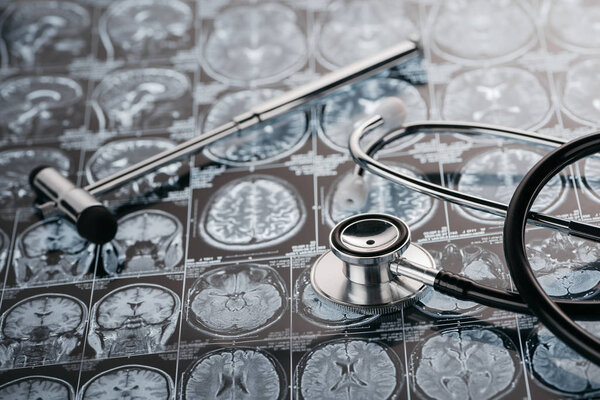 reflex hammer and stethoscope