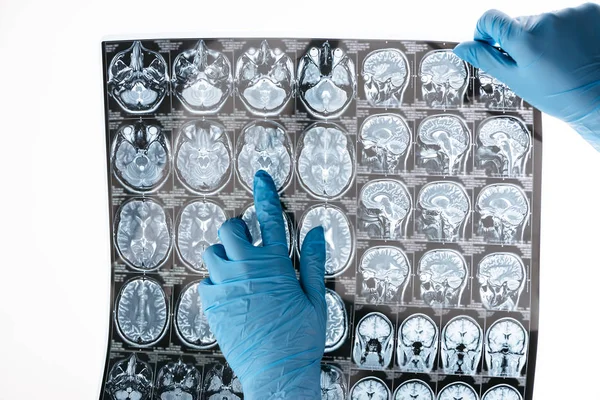 Doctor holding x-ray picture — Stock Photo
