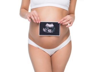 pregnant woman with ultrasound scan clipart