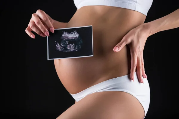 Беременная женщина с ультразвуковым сканированием — стоковое фото