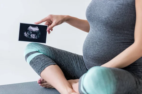 Pregnant woman with ultrasound scan — Stock Photo