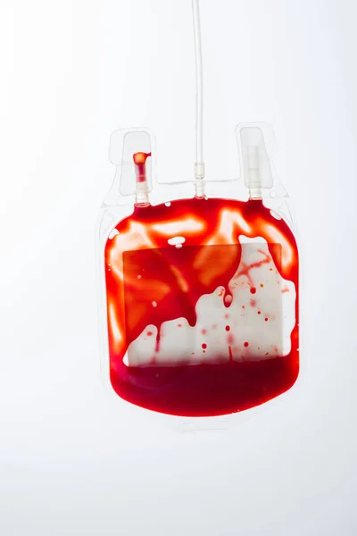 Bolsa de sangre para donación - foto de stock