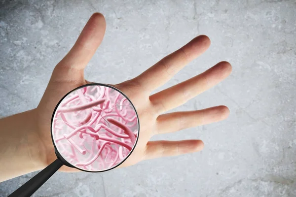 Male hand with germs — Stock Photo, Image