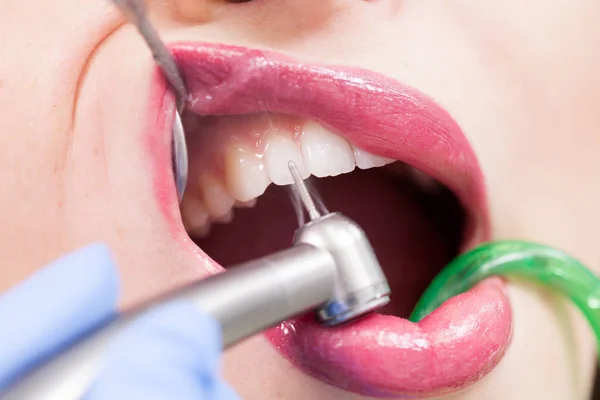 여성 환자를 치료하는 치과 의사 — 스톡 사진