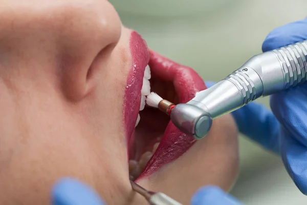 Dentista curando a una paciente femenina —  Fotos de Stock