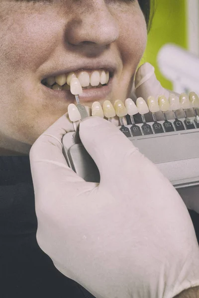Dentist choose white of teeth — Stock Photo, Image