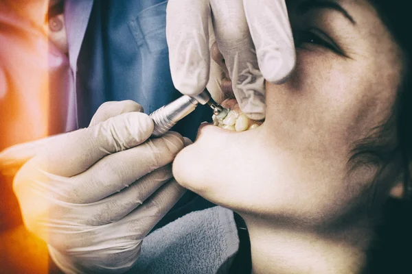 Dental Cleaning Close-up — Stock Photo, Image