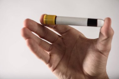 Adamın eli bir test tüpünde kan tutuyor. Yakın çekim, fiziksel muayene, örnek alma, enfeksiyon kontrolü.