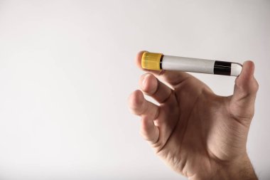 Adamın eli bir test tüpünde kan tutuyor. Yakın çekim, fiziksel muayene, örnek alma, enfeksiyon kontrolü.