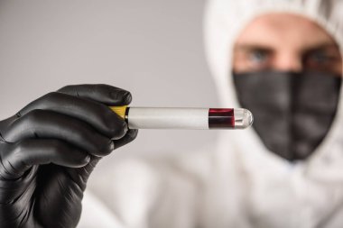 Siyah maskeli ve beyaz koruyucu giysi giyen bir virüs uzmanı kan testleri ve koronavirüs için örnekler yapar, testler yapar. Salgın. Salgın yüzünden izole ve panik içinde.. 