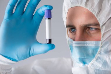 Tıbbi maskeli ve koruyucu giysili bir virüs uzmanı üzerinde koronavirüs testi için kan örneği olan bir test tüpü tutuyor. Salgın. Solunum sendromu, panik, deneyimler, araştırma