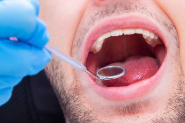 Dişçi aletleriyle ağzını kapat.