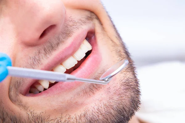 Zbliżenie Jamy Ustnej Pomocą Narzędzi Dentystycznych — Zdjęcie stockowe