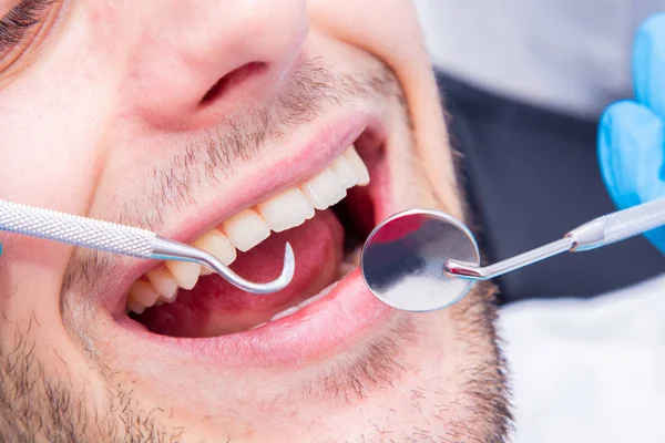 Zbliżenie Narzędzi Dentystycznych Ustach Pacjenta — Zdjęcie stockowe