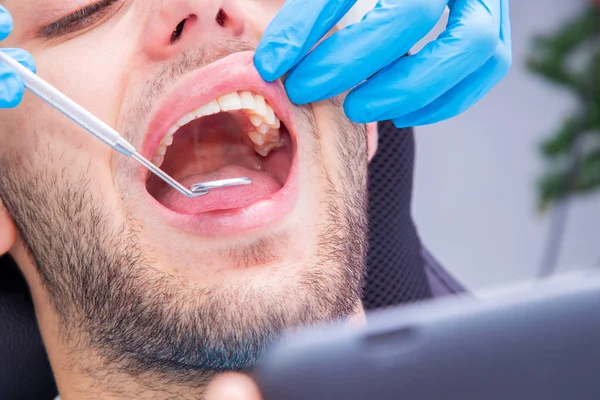 Stomatolog Narzędziami Pracującymi Ustach Pacjenta — Zdjęcie stockowe