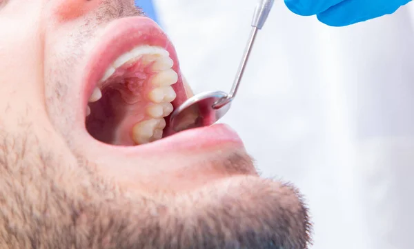 Stomatolog Narzędziami Pracującymi Ustach Pacjenta — Zdjęcie stockowe