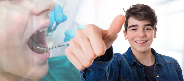 Young Teenage Boy Braces Orthodontics Okay Sign Dentist Background — Stock Photo, Image