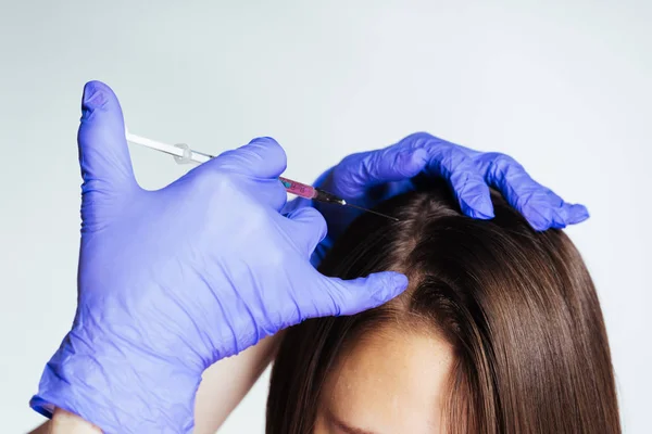 O médico faz a menina injeções na cabeça para crescer e fortalecer o cabelo — Fotografia de Stock