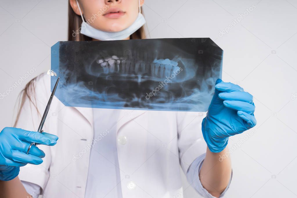 young woman doctor holding an x-ray of teeth