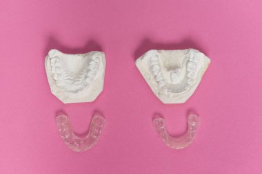 Beyaz bir alçı diş üzerinde pembe yüzeydir