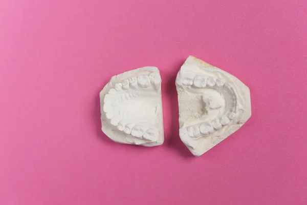 На розовом фоне лежат гипсовые слепки зубов — стоковое фото