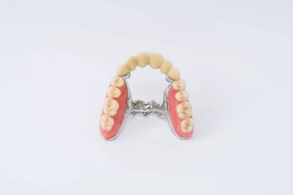 Полный протез зубов — стоковое фото