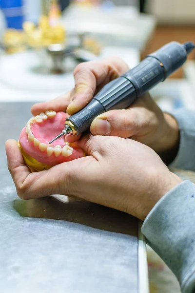 Trabalhando com uma broca em uma prótese dentária — Fotografia de Stock