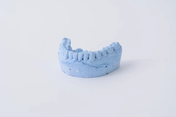 Molde de prótesis dental — Foto de Stock