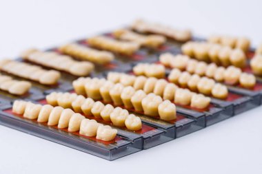 Diş katalog tablolarının
