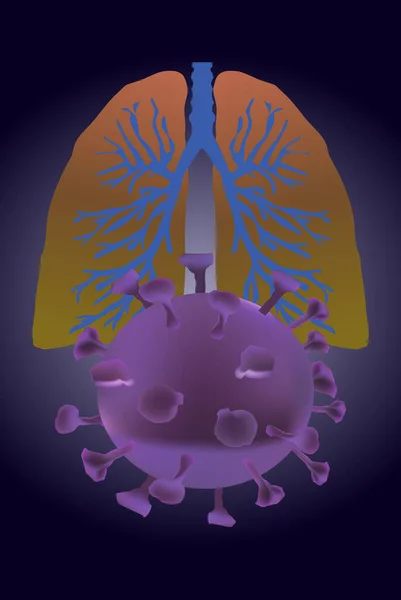 Menschliche Lungen Mit Zweigen Mit Virusmolekülen Vektor Illustration — Stockvektor
