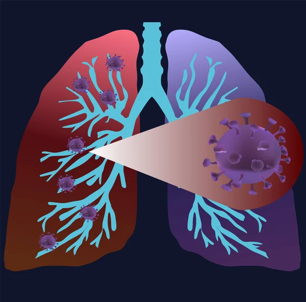 Pulmones Humanos Con Ramas Con Moléculas Virus Vector Ilustración — Archivo Imágenes Vectoriales