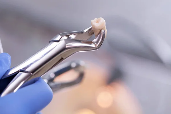 Dental equipment,tooth extraction — Stock Photo, Image