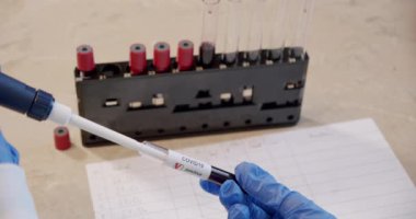 Koruyucu giysi giyen doktor kolları kanla tıbbi test tüpü tutuyor ve test ekipmanları ve koronavirüs pozitif. Üst görünüm