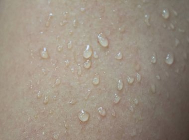 insan derisi üzerinde su damlaları