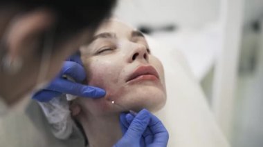 Kadın s deri altında iğne ekleme ve kaldırma Cosmetican