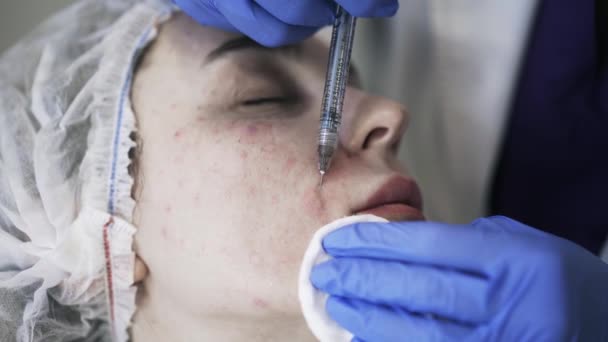 Cosmetician esfregando a cara após injeciton — Vídeo de Stock