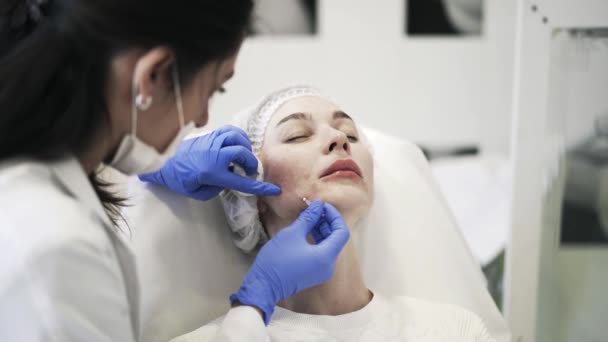 Косметолог вставляє голки під шкіру — стокове відео