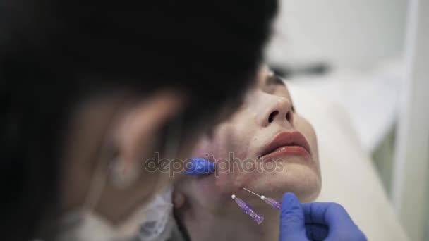 Cosmetician removing needles from woman s face — Stock Video