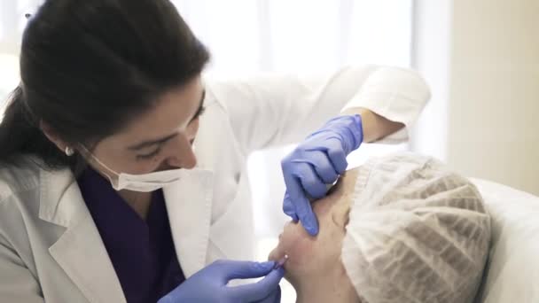 Kosmetikerin führt Nadel in Wange ein, Seitenansicht — Stockvideo