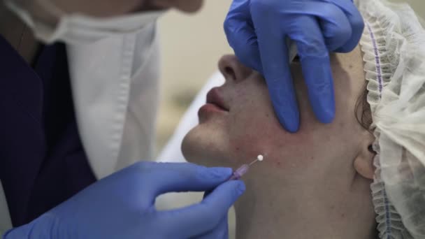 Kosmetikerin führt Nadel in Wange ein, Nahaufnahme — Stockvideo