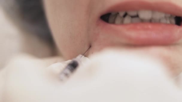 Косметолог робить знімок краси під жіночою губою — стокове відео