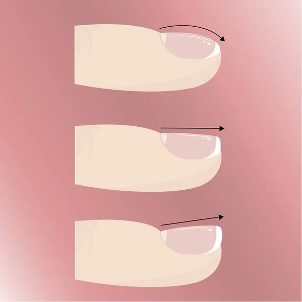 Variedades de diferentes formas e tipos de placa de unha. Extensões de manicure e unhas —  Vetores de Stock