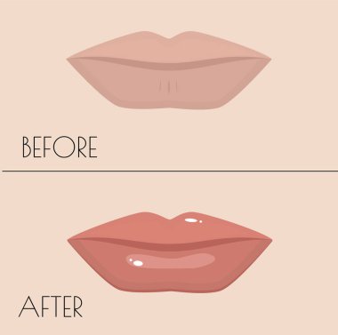kalıcı makyaj dudak. Önce ve sonra yordamı