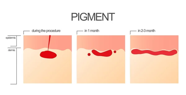 The process of engraftment of the pigment after the salon procedure of permanent make-up. — Stock Vector