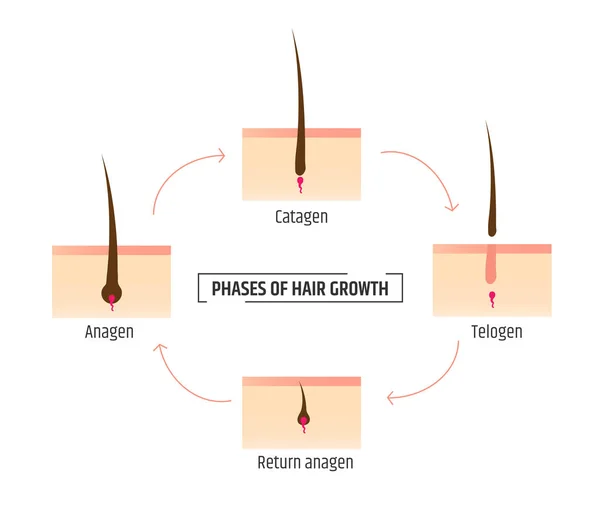 Fases de crecimiento del cabello. Infografías tricología y dermatología. Depilación láser — Vector de stock