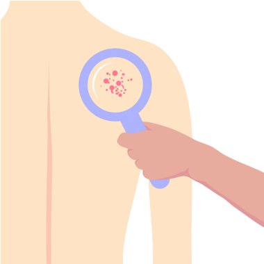 Bir dermatolog hastaların tenlerini büyüteçle muayene eder..