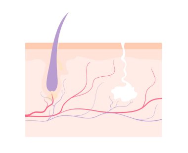 Human skin with hair follicle, sweat gland and capillaries.