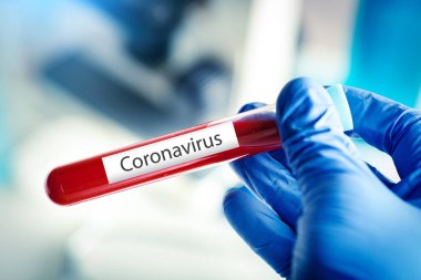 Laboratuvarda Coronavirus. Kan Testi yapan bir bilim adamı. Yeni Salgın Coronavirüs 2019 nCoV. Kopyalama alanı olan arkaplan.